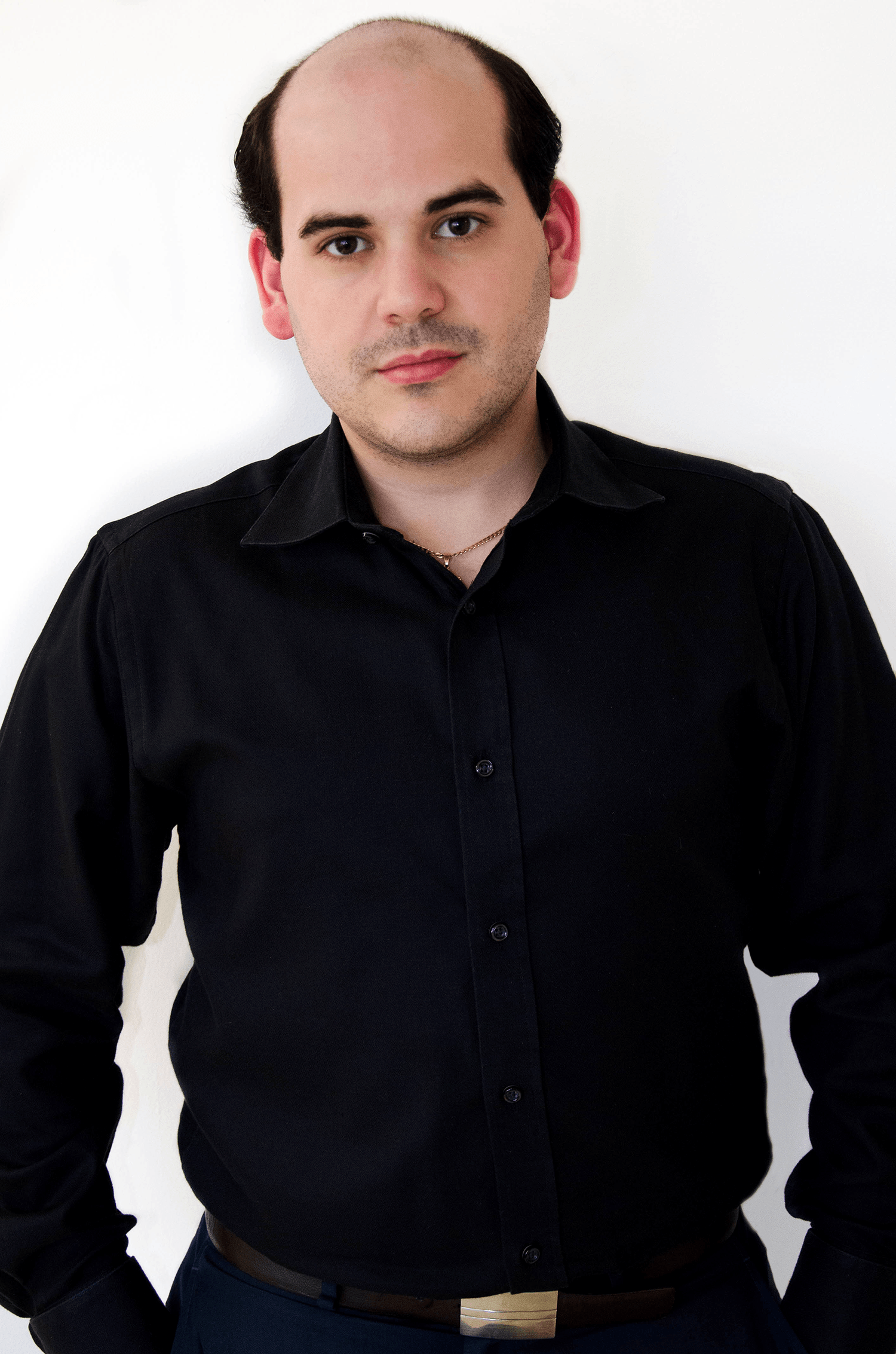 Asnardo Before the Treatment — Philadelphia, PA — Carmine's Hair Studio