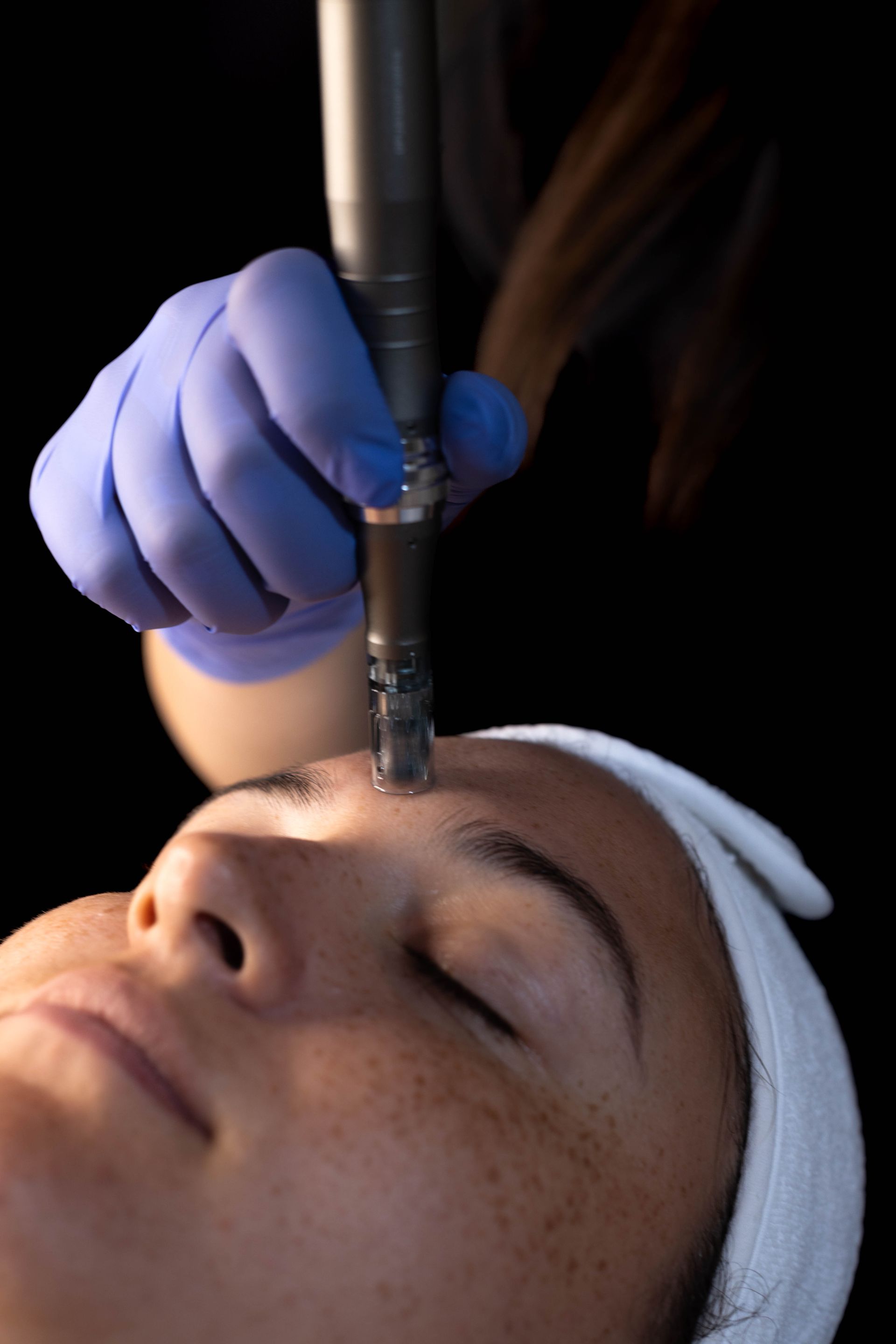 A person in blue gloves performs microneedling on a client's forehead in a dark setting.