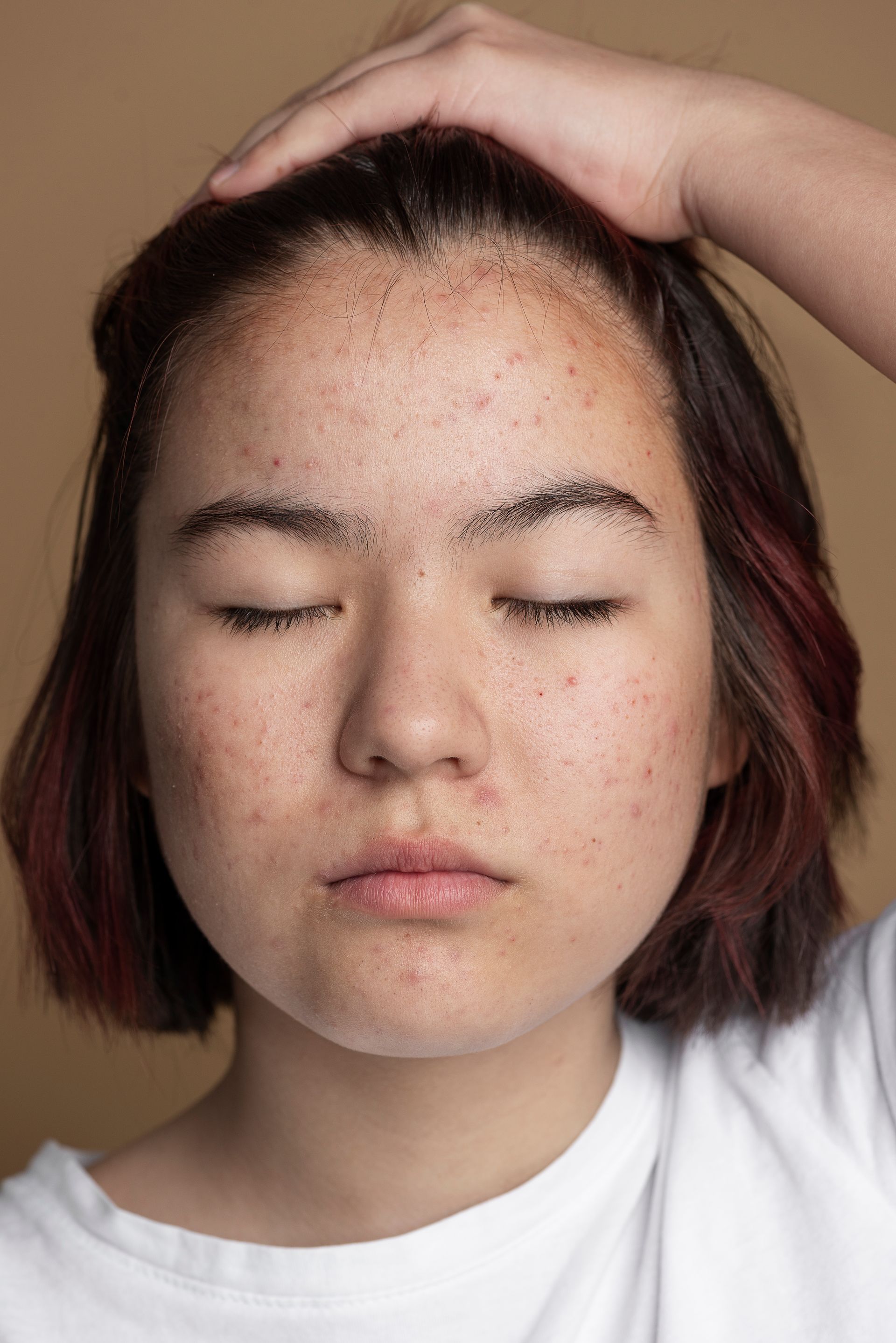 A person with closed eyes and visible skin texture rests their hand on their head against a plain tan background.