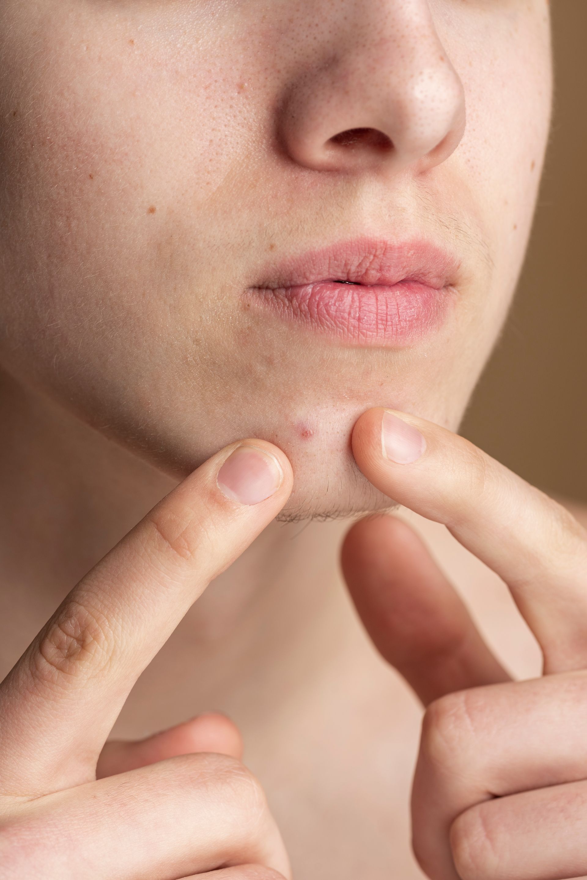 A close-up of a person's chin as they use their fingers to inspect a small spot on their skin.