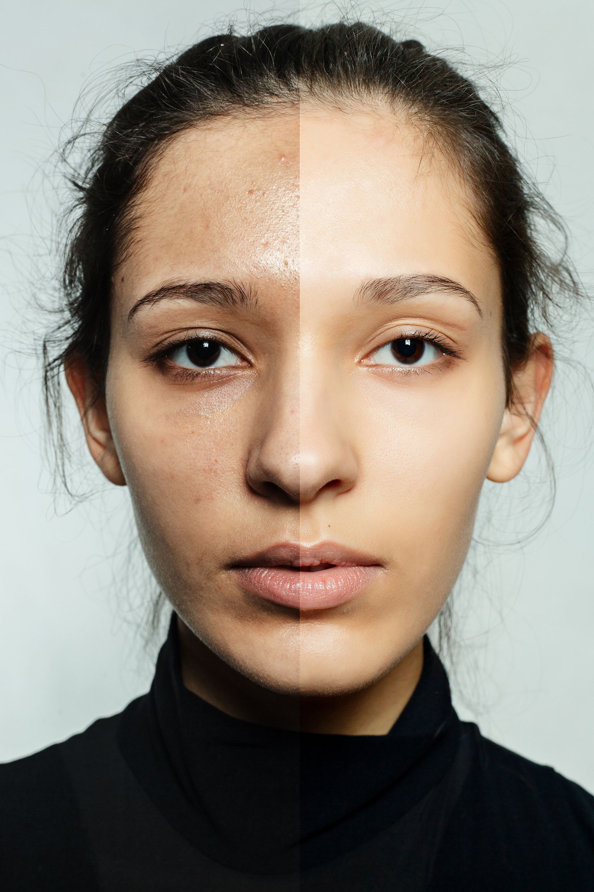 A person's face shown in a split-screen effect, comparing skin texture on the left side to a smoothed appearance on the right.