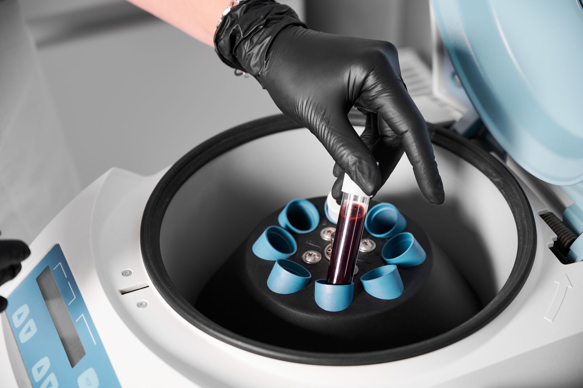 a blood test tube in a centrifuge