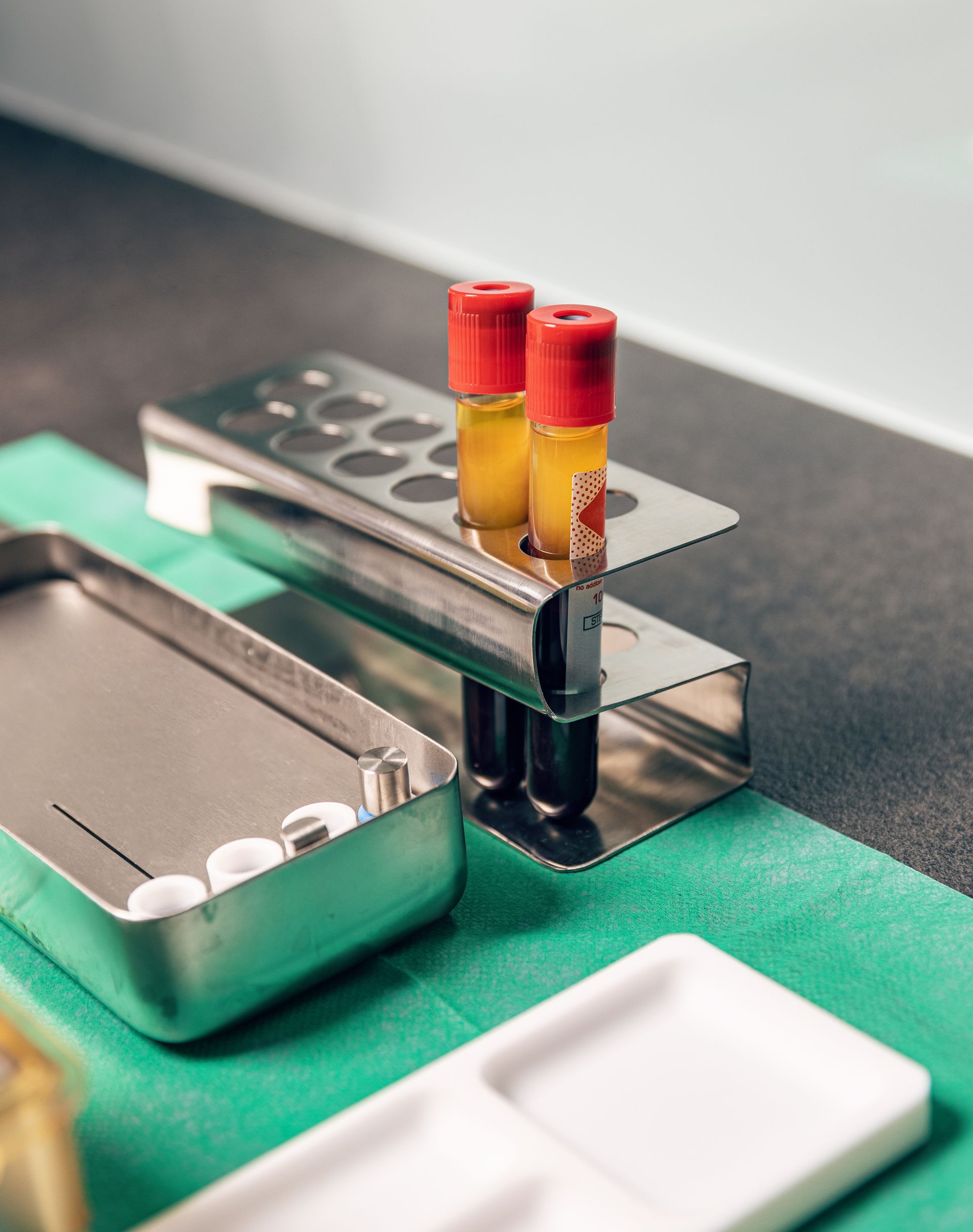Two test tubes are sitting on top of a metal tray on a table.