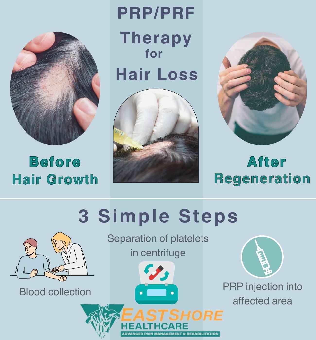 Prf Hair Restoration Eastshore Healthcare