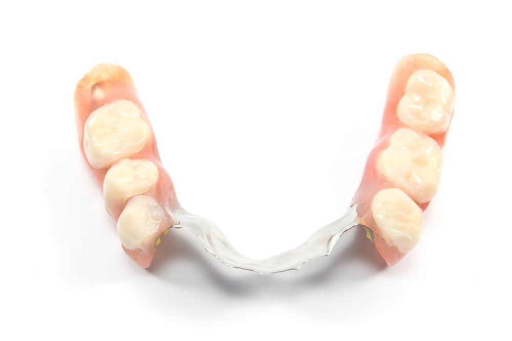 Partial Denture — Island Sands Dental in Boyne Island, QLD