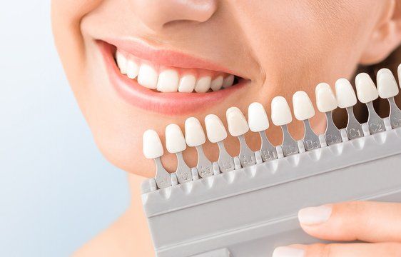 Clean White Teeth — Island Sands Dental in Boyne Island, QLD