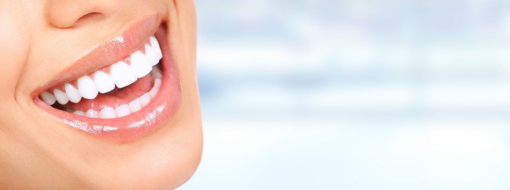 Woman With Straight White Teeth — Island Sands Dental in Boyne Island, QLD