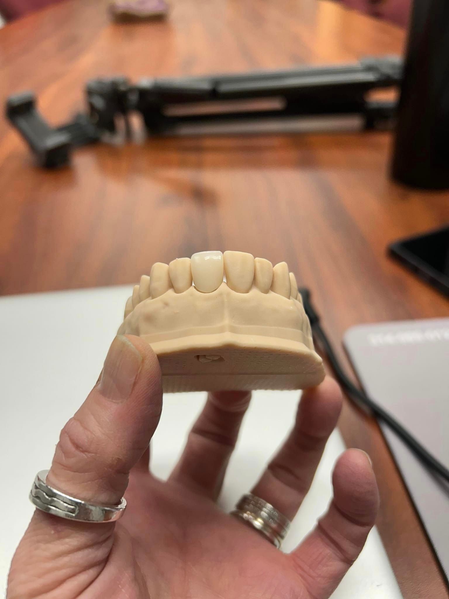 How 3D printed dental crowns are changing the dental world