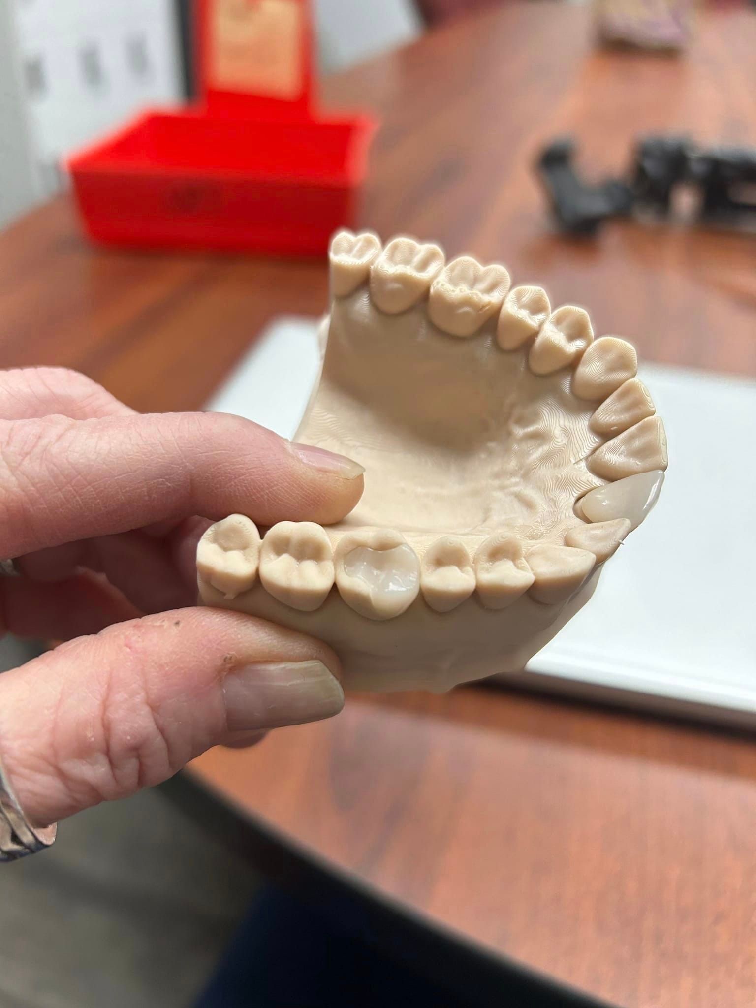 3d printed dental crowns in st louis, mo