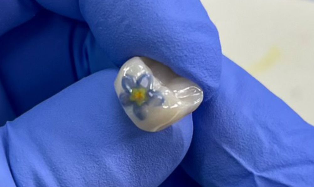 tooth tattoo on a dental crown flower