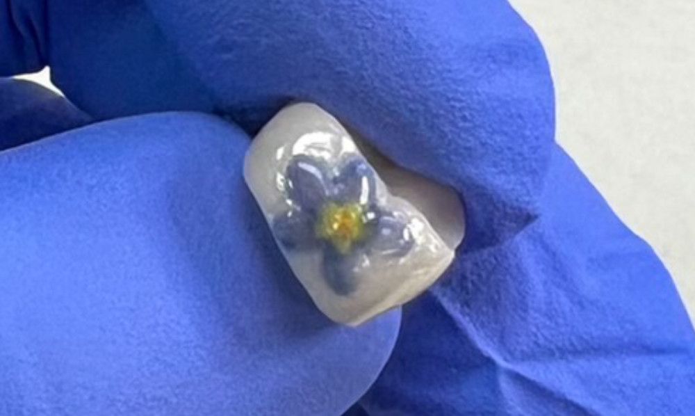 custom design on a dental crown