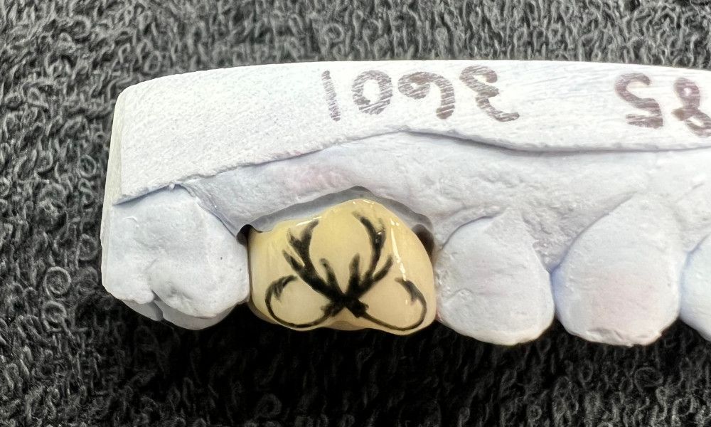 hooks and antlers tooth tattoo