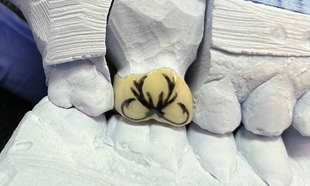 hooks and antlers tooth tattoo