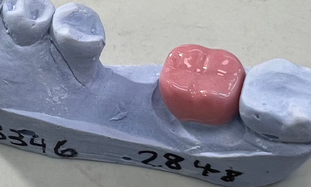 tooth tattoo on a dental crown for breast cancer
