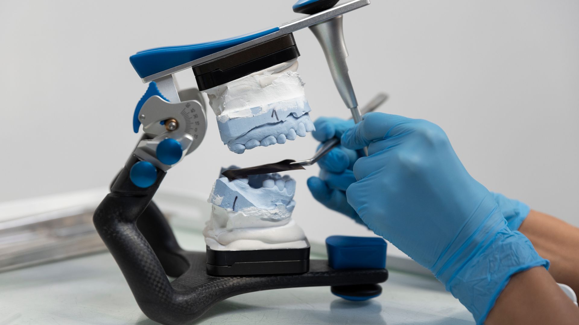 Dental model of teeth being prepared for restoration work at Summit-Horizon Dental Lab.