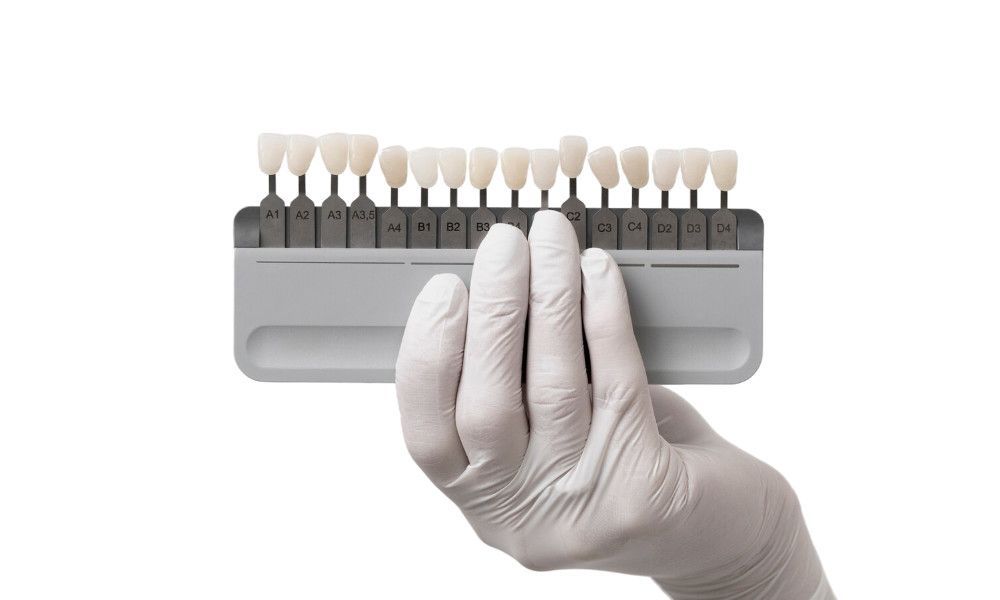 3-unit bridge esthetic options for anterior and posterior bridges