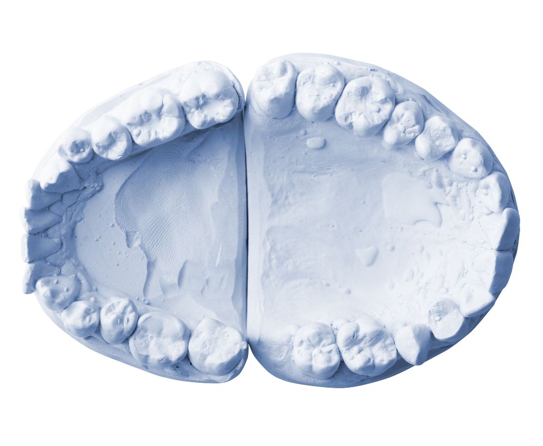 plaster mold of teeth for creation of dental lab product