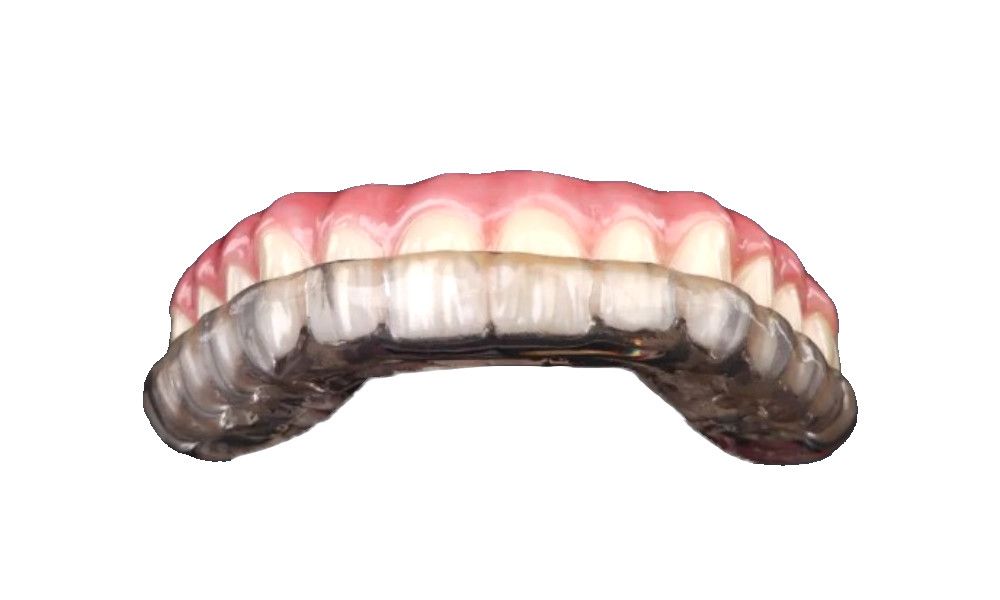 hard occlusal night guard