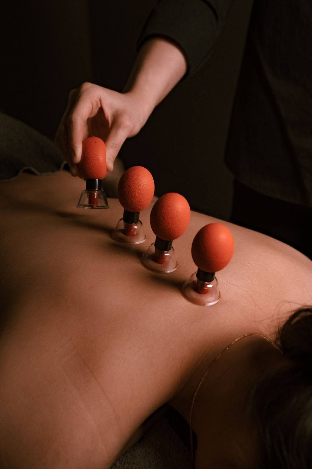 Cupping Therapy - Absolute Wellness