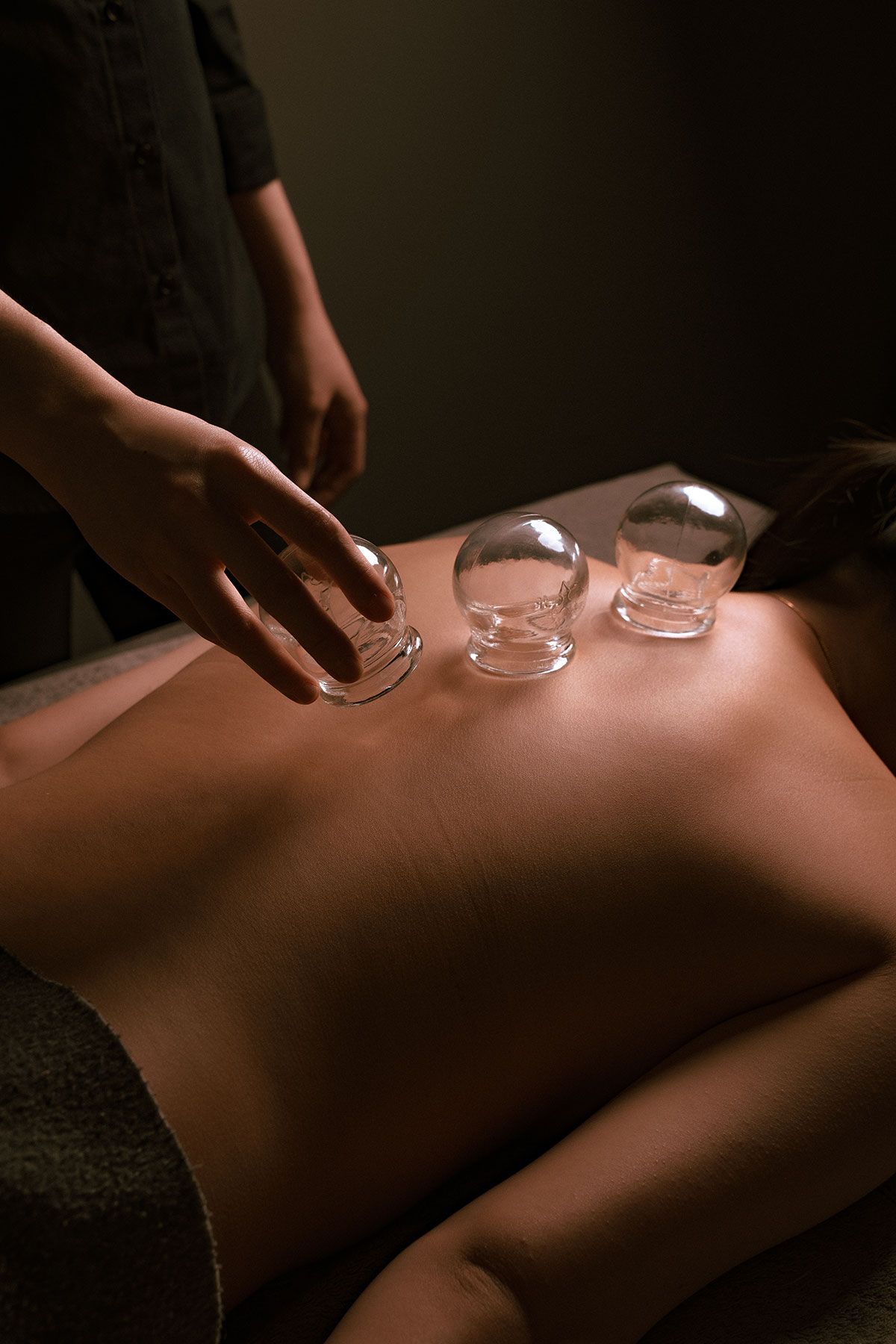 Reasons for the Resurgence of Ba Guan (cupping therapy) in Modern Wellness Practices - Absolute Well
