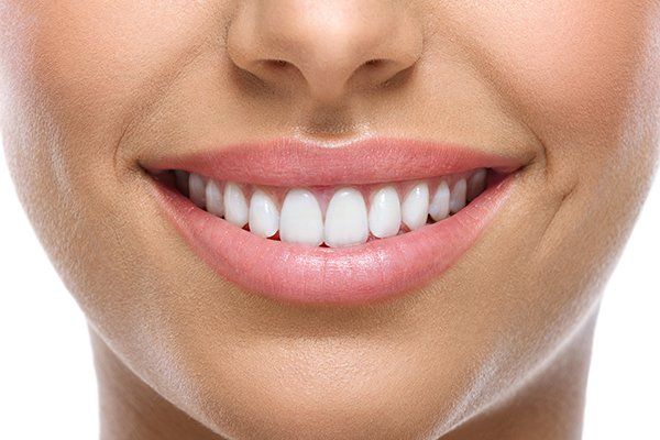 Teeth Whitening — Rogers, AR — Ozark Comprehensive Dentistry