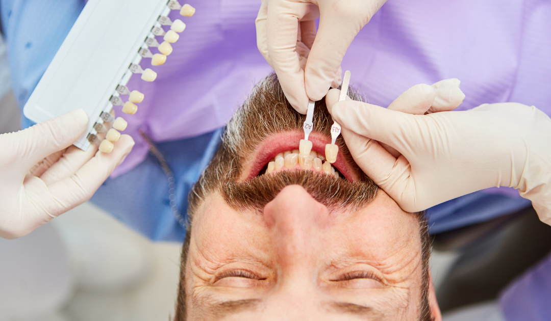 Dental Bonding — Rogers, AR — Ozark Comprehensive Dentistry