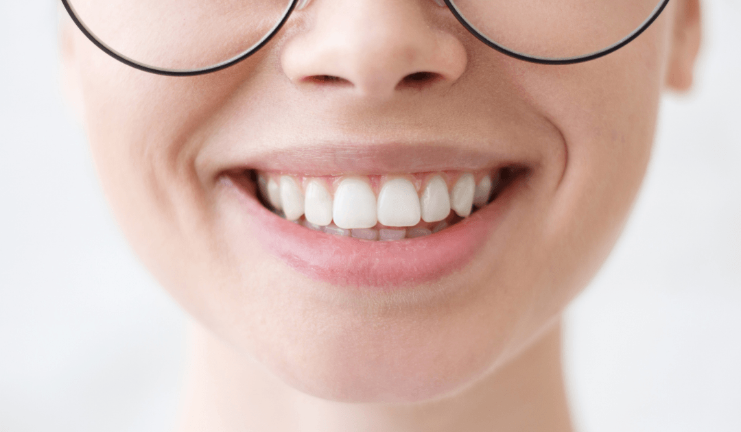 Beautiful Smile of a Lady — Rogers, AR — Ozark Comprehensive Dentistry