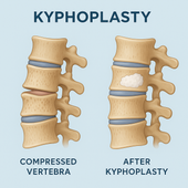 A cartoon illustration of a spine with a smiling face