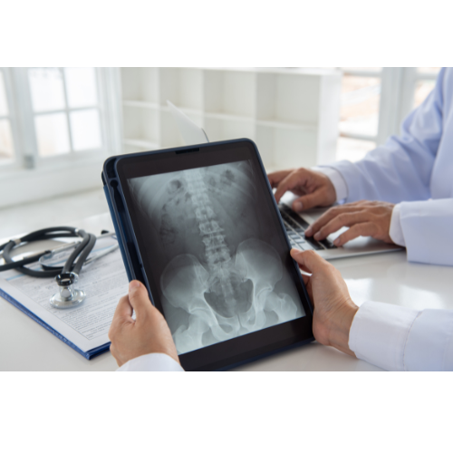 A doctor is looking at an x-ray on a tablet.