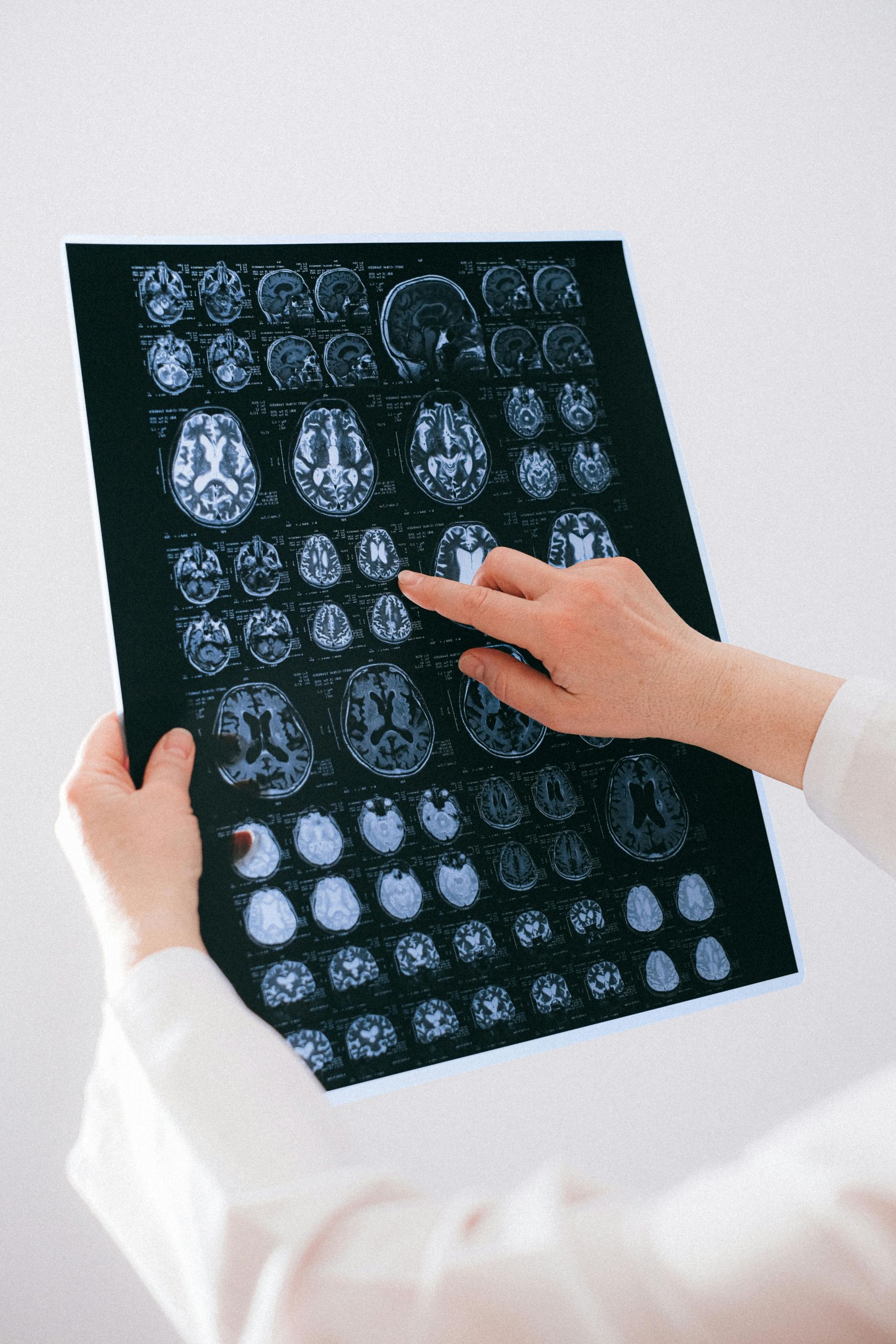 Person pointing at a brain scan; held up against a white background.