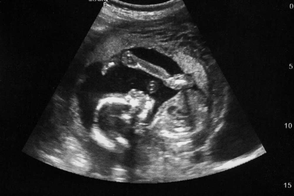 free ultrasound services in Arizona