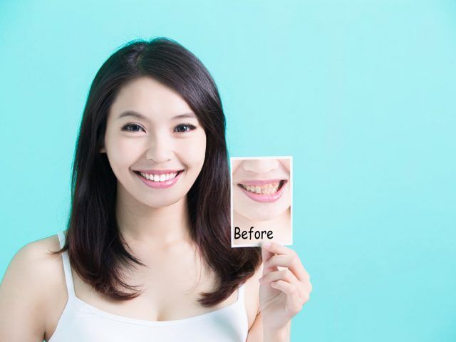 Woman holding up a before and after picture