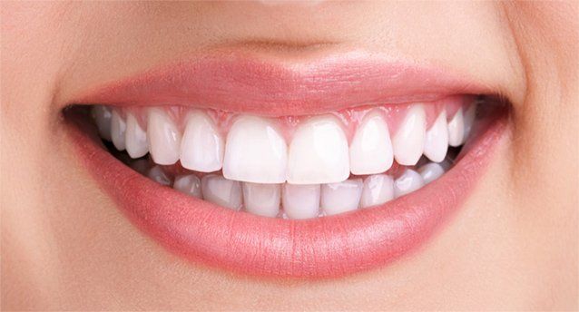 teeth after cleaning and whitening
