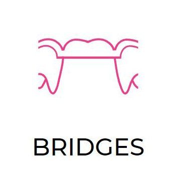 Dental Bridges