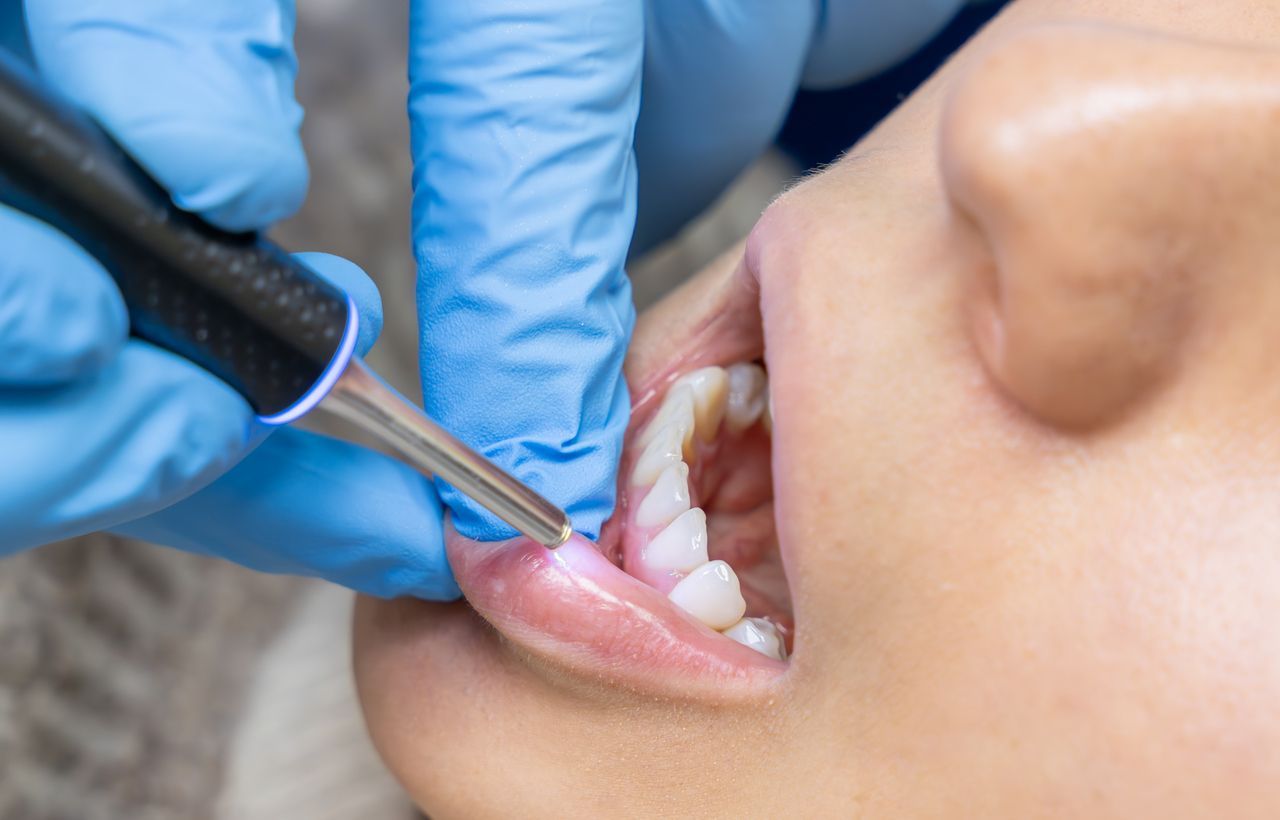 Dentist uses a tool on a patient's lip inside their mouth; gloved hand, dental setting.