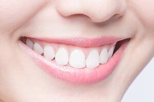 Teeth Whitening - Cleanings and Prevention in Las Vegas, NM