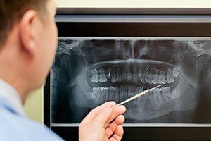 Dental X-Ray - Dentists in Las Vegas, NM