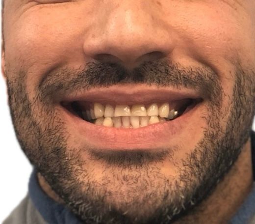 Man with beard smiling, showing teeth.