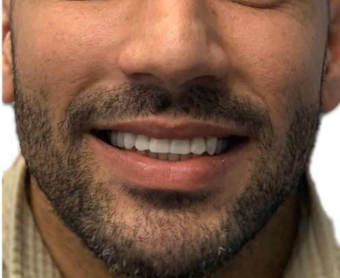 Smiling man with dark beard, showing straight, white teeth.