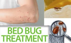 Bed Bug Treatment Houston Tx