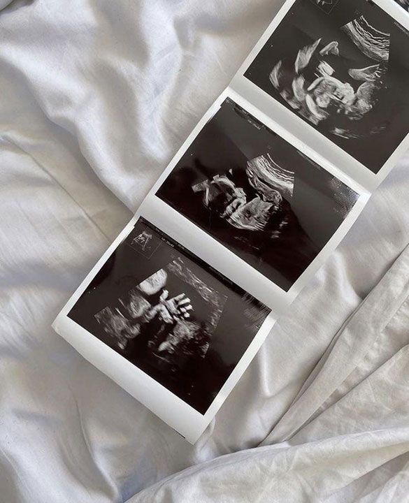 FEMME GINECOLOGÍA Y OBSTETRICIA INTEGRAL