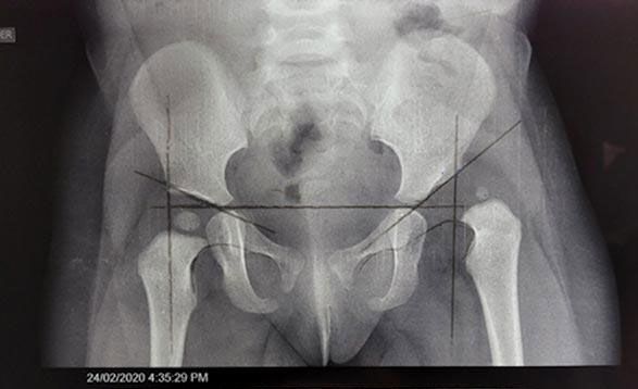 Dr. Heber Avitia Salazar