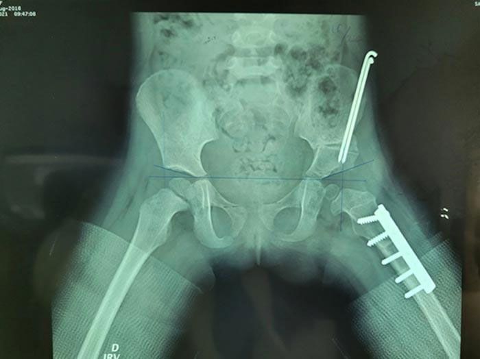 Dr. Heber Avitia Salazar