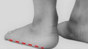 Dolore alla pianta del piede