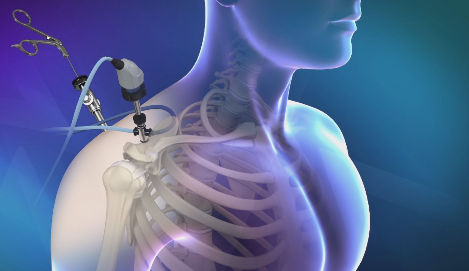 Rappresentazione grafica trattamento