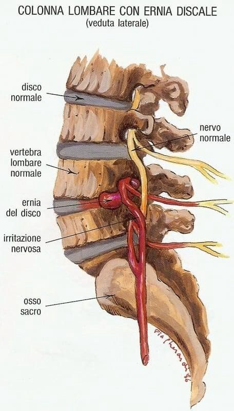 Disegno con zone del corpo