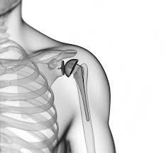 Rappresentazione grafica trattamento