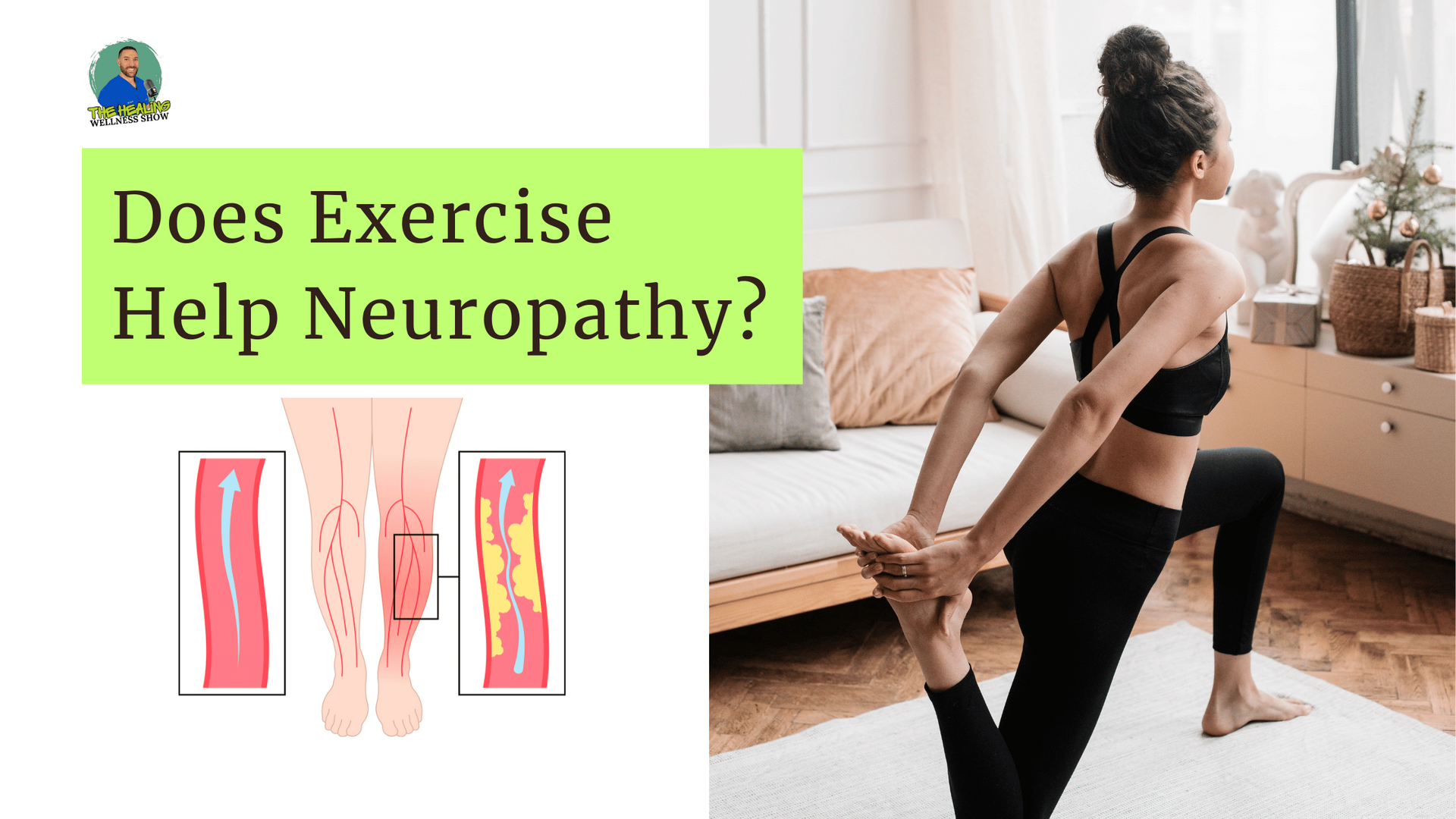 Does Exercise Help Neuropathy?