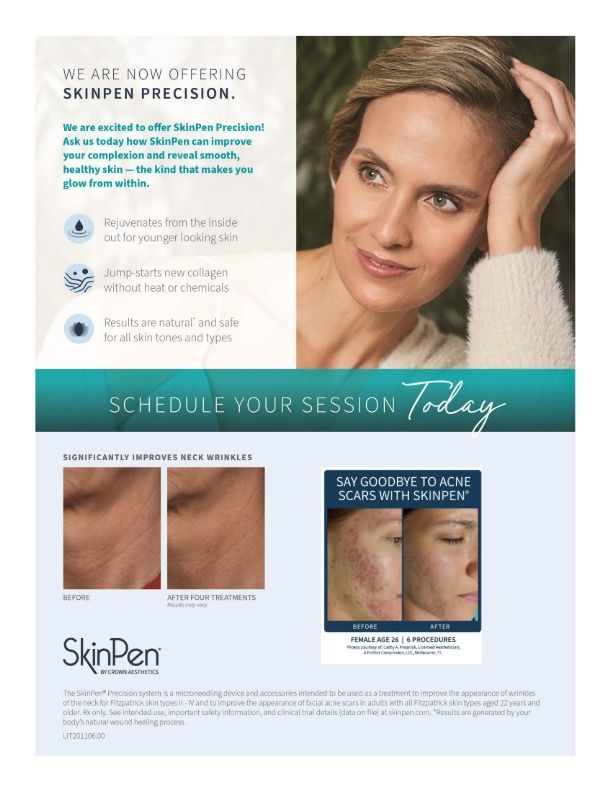 Improve your Complexion with SkinPen!