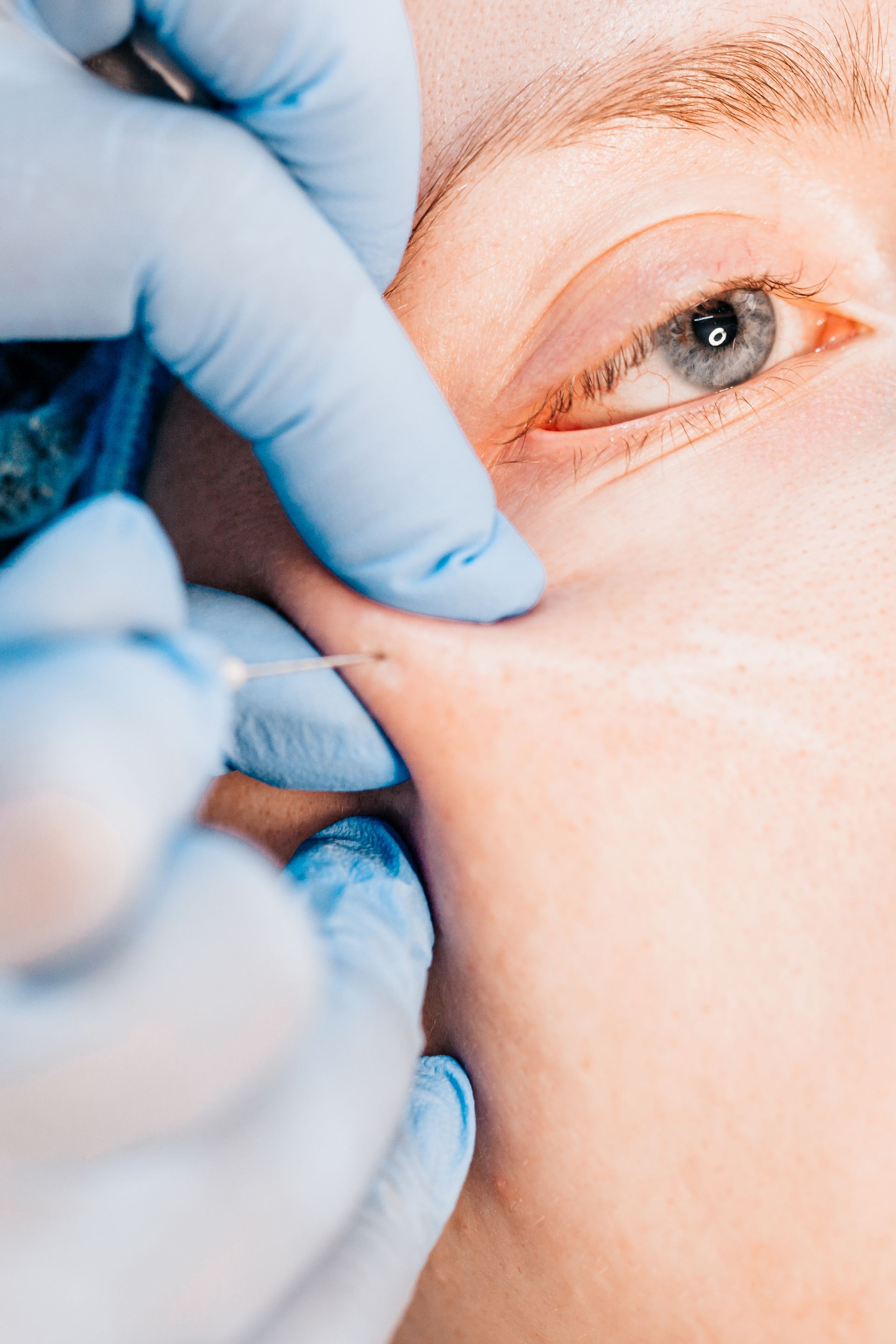 A close up of a person getting a tattoo on their face.